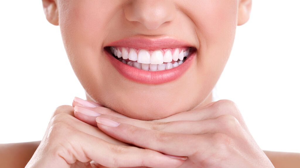 Which at-home prep steps should I follow before whitening to minimise discomfort with Aspire White?