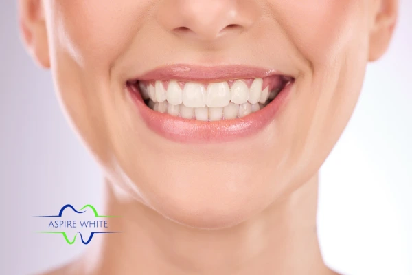 Follow your teeth whitening aftercare Mansfield to prolong your whiter smile!