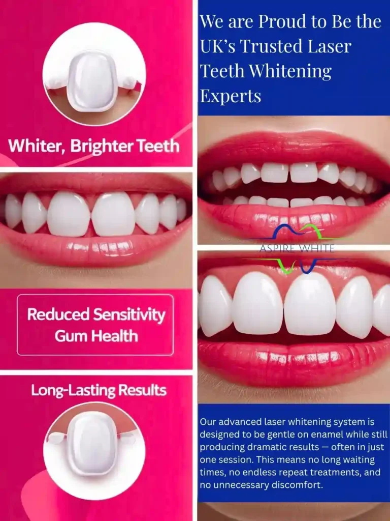 We are Proud to Be the UKs Trusted Laser Teeth Whitening Experts